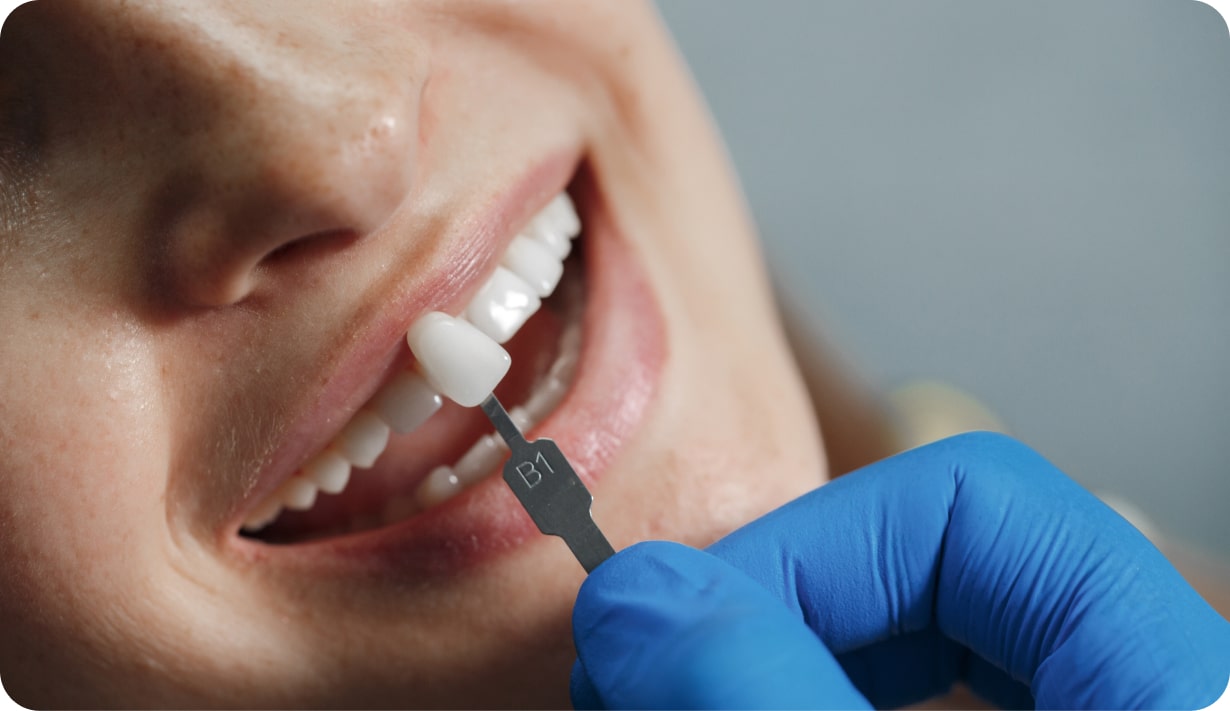 Restorative Dentistry - Precision Dentistry of Howard