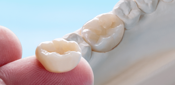 Dental Emergencies - Precision Dentistry of Howard