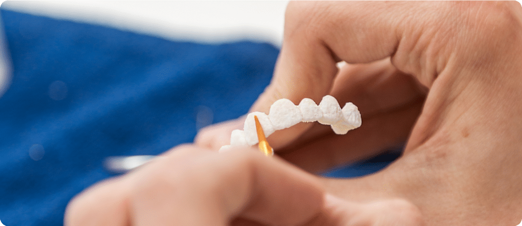 Veneers - Precision Dentistry of Howard