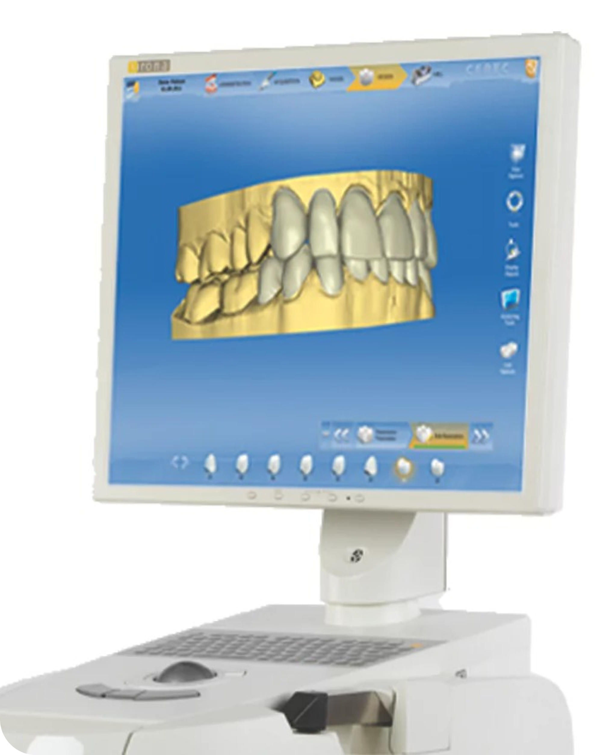 CEREC One-Visit Crown - Precision Dentistry of Howard