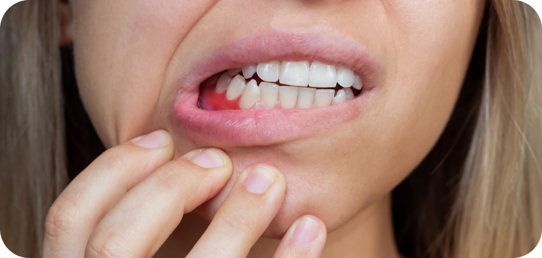 Gum Disease Treatment - Precision Dentistry of Howard