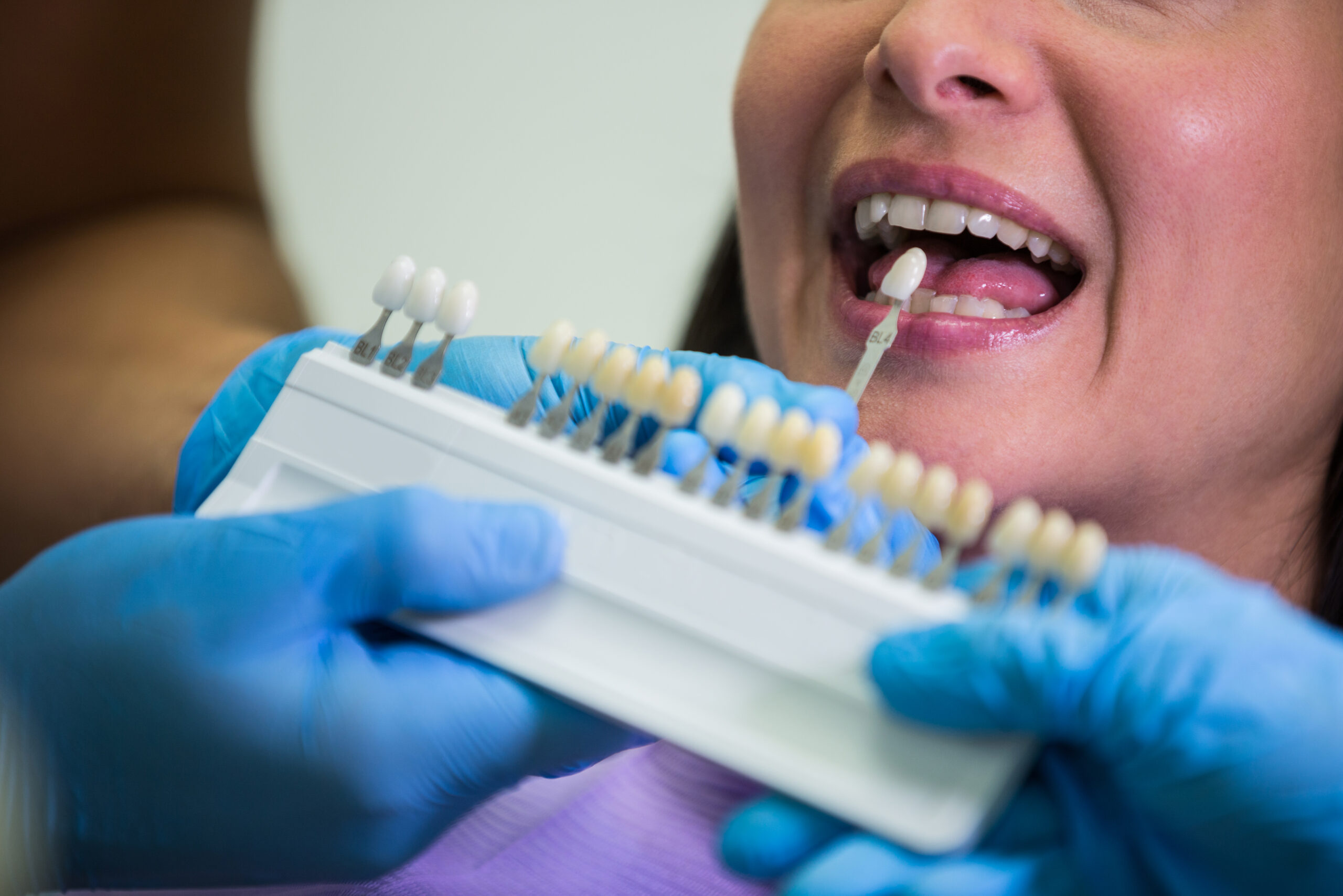 Blog - Precision Dentistry of Howard
