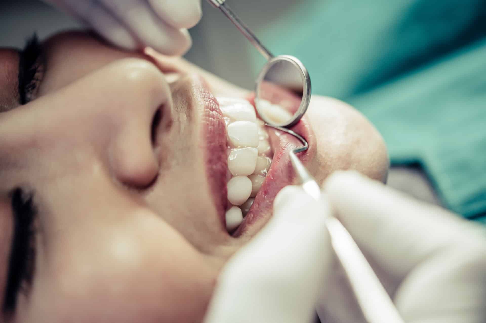Blog - Precision Dentistry of Howard