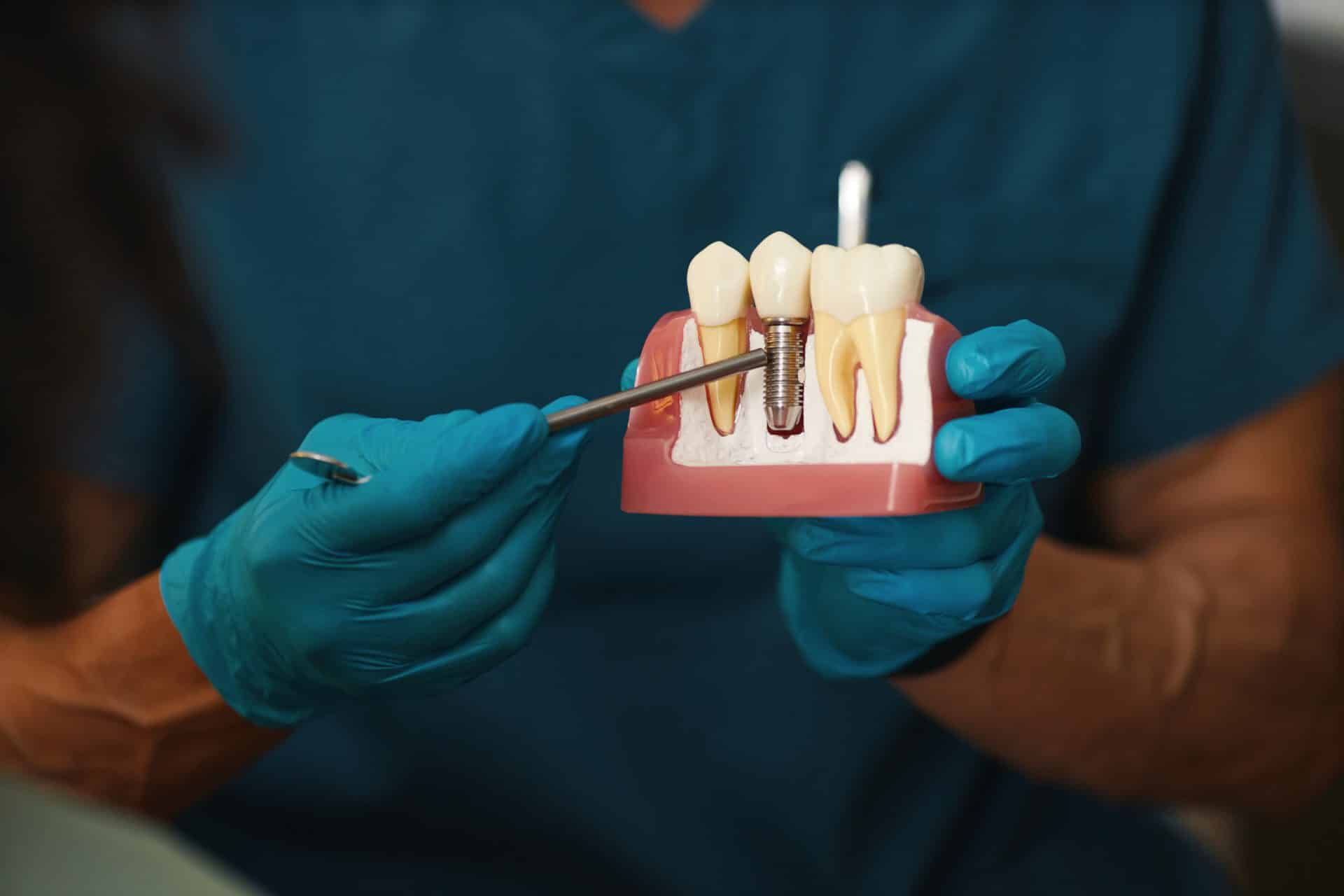 Dental Implant Option